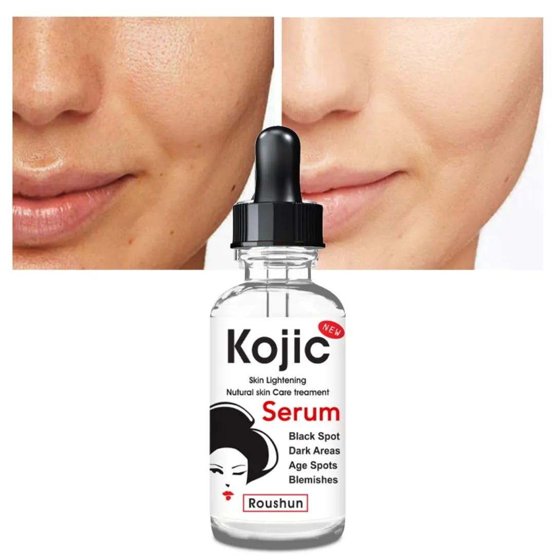 Kojic Skin Brightening Serum